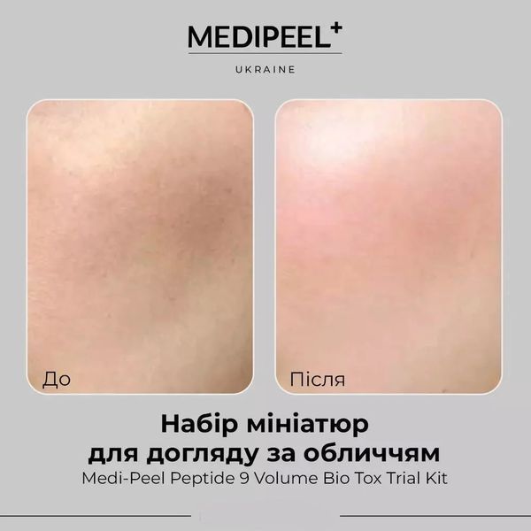 Набір мініатюр для догляду за обличчям з пептидами Medi-Peel Peptide 9 Volume Bio Tox Trial Kit MD00003 фото